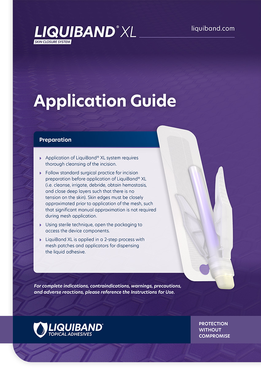 LiquiBand® XL Application Guide English